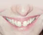 teeth