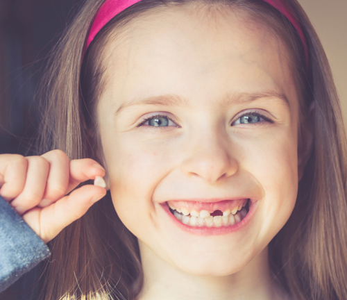 What to do when you lose a tooth?