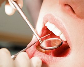 Why are Fissure Sealants so important?