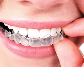 A Brief History Of Braces