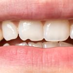 Dental Excellence Managing-broken-chipped and loose teeth at home