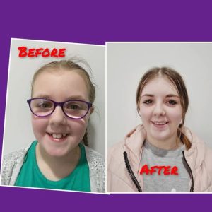 Patient before and after case study 3