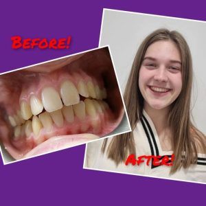 Patient before and after case study 4