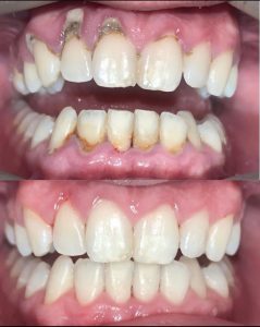 Patient before and after case study 8