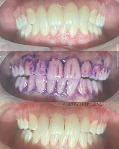 Patient before and after case study 10