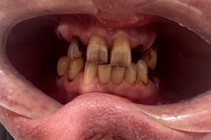 Patient before case study 1