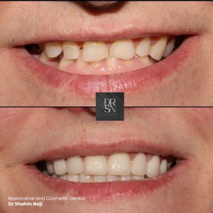 Patient before and after case study 7. Patient before and after case study 7